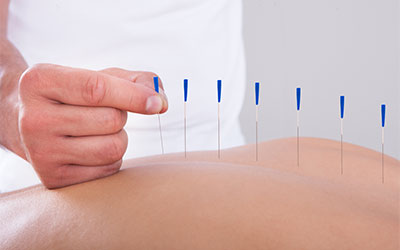 Enhancing Athletic Performance and Recovery with Acupuncture Treatment